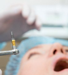Gloved hand holding instrument with dental implant about to be placed in patient’s mouth