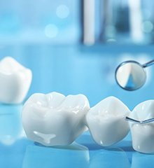 an example of a dental bridge