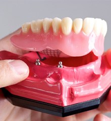 model dental implant next to a stack of money