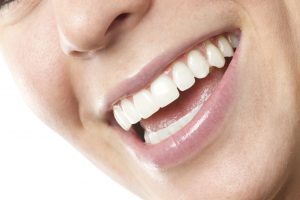 Your cosmetic dentist in Farmington will transform your smile with porcelain veneers.