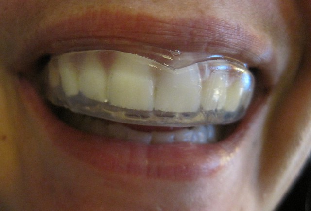 person wearing dental mouthguard